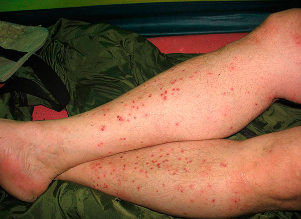 Pour que les loisirs de plein air ne soient pas éclipsés par des piqûres d'insectes constantes, il est utile d'acheter à l'avance l'agent de protection approprié - nous continuerons à parler plus en détail de la façon de le choisir ...