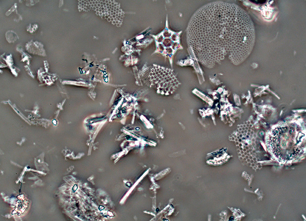 Particules de diatomite sous un microscope.