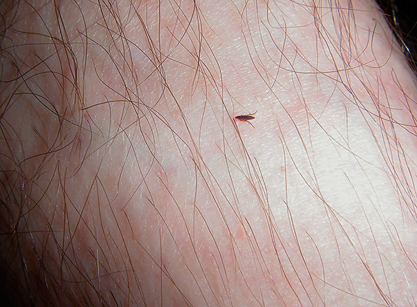 Puce sur la peau humaine