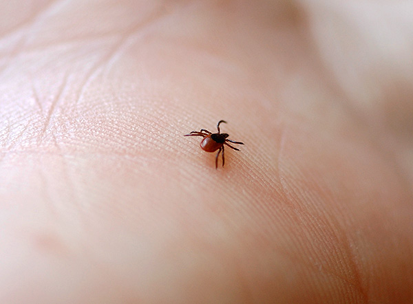 Voici à quoi ressemble une personne affamée.