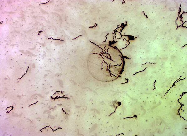 Borrelia burgdorferi au microscope (grossissement 400x).