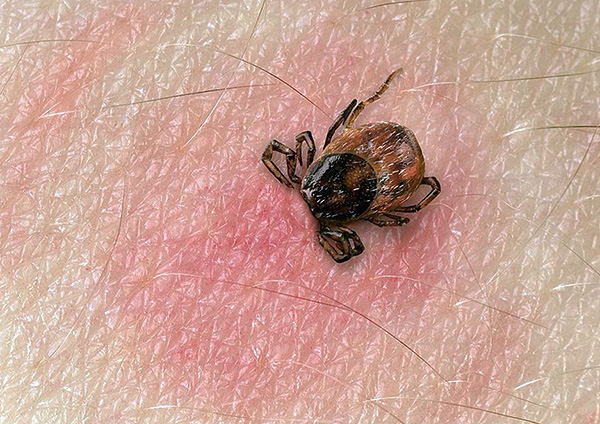 Souvent, les gens ne remarquent une tique que lorsque le parasite a déjà réussi à coller et à commencer le processus de saturation en sang.