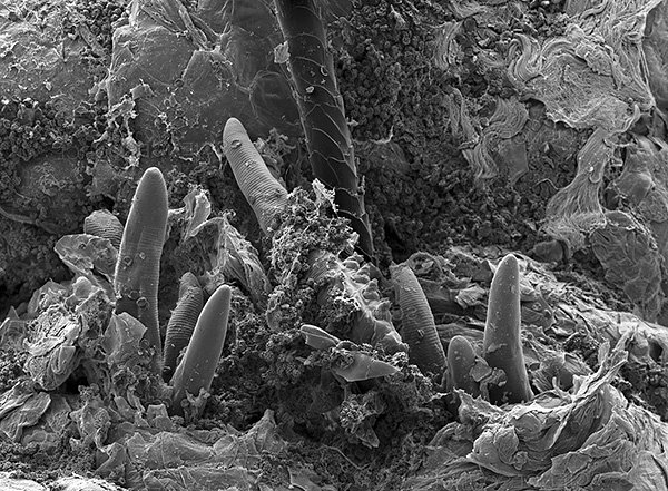 Dans la plupart des cas, le corps humain ne souffre pas de l'activité vitale parasitaire des glandes.