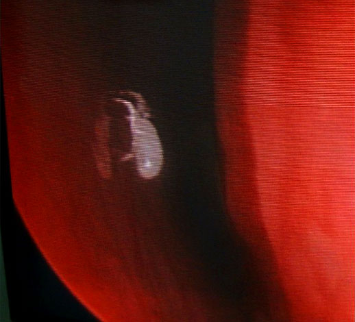 Les ancêtres de ces parasites peuvent avoir vécu dans des terriers d'animaux (y compris des tanières de loups), et certains individus sont accidentellement entrés dans les voies respiratoires de leurs hôtes et ont progressivement appris non seulement à y survivre, mais aussi à se reproduire.