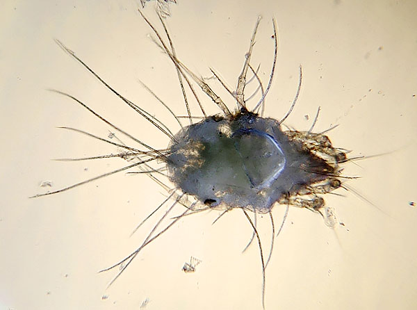 C'est pour lutter contre les acariens du sucre que les usines doivent traiter les matières premières et les produits avec des moyens spéciaux, ce qui entraîne une augmentation du coût du produit final.