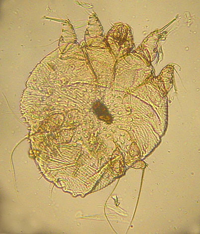 démangeaison de la gale féminine