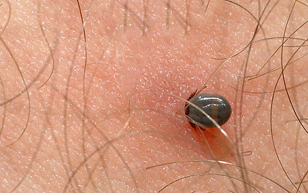 Ces suceurs de sang sont porteurs d'agents pathogènes d'un certain nombre de maladies mortelles chez l'homme et les animaux domestiques.