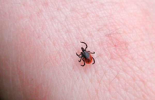 Dans de nombreux cas, le parasite se retrouve déjà attaché à la peau, car son mouvement à travers le corps ne peut pas toujours être ressenti.