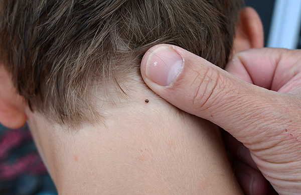 Pour sucer le sang, le parasite essaie de trouver la zone avec la peau la plus fine.