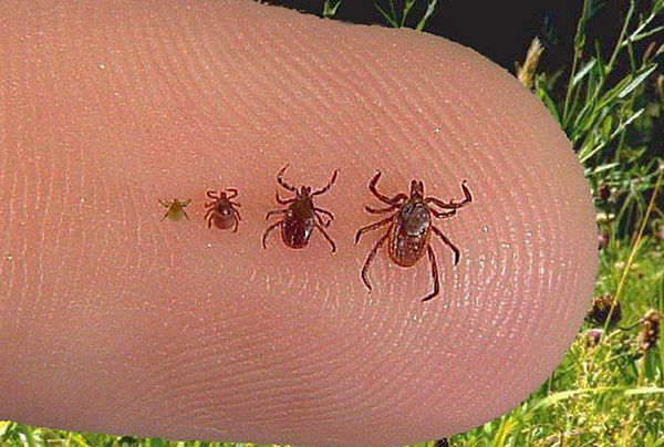 Et donc les parasites regardent les différentes étapes de leur développement.