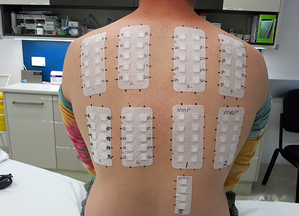 Un exemple d'utilisation d'un patch test