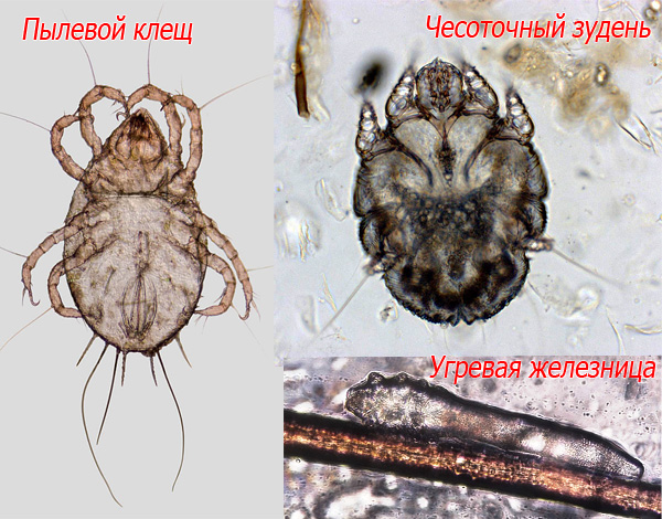 Voici à quoi ressemblent les acariens, la gale et les glandes acnéiques sous un microscope.