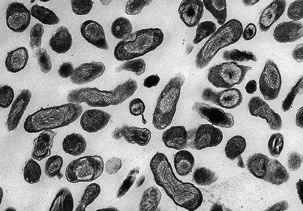 L'agent causal de la fièvre Q (Coxiella burnetii)