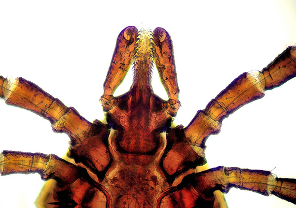 Appareil buccal d'une tique de chien sous un microscope.
