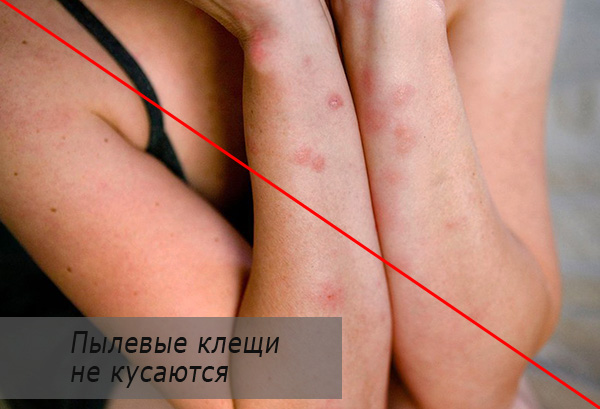 Les acariens ne piquent pas les humains ni les animaux domestiques.