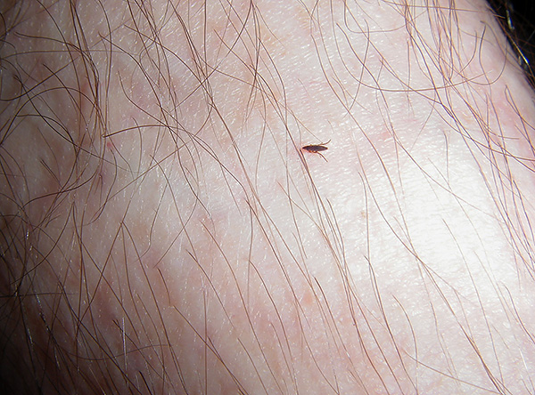 Les puces piquent non seulement les animaux, mais aussi les humains.