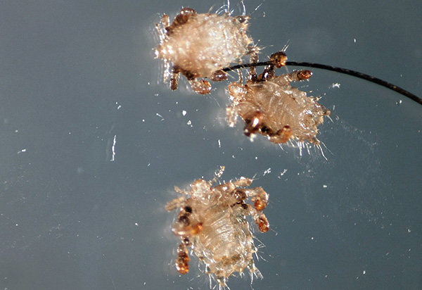 Les poux du pubis ressemblent à de petits crabes