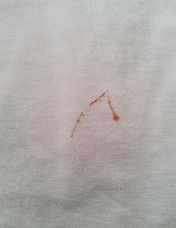 Habituellement, de telles traces se forment lorsqu'une personne dans un rêve appuie légèrement sur un parasite saturé de sang.