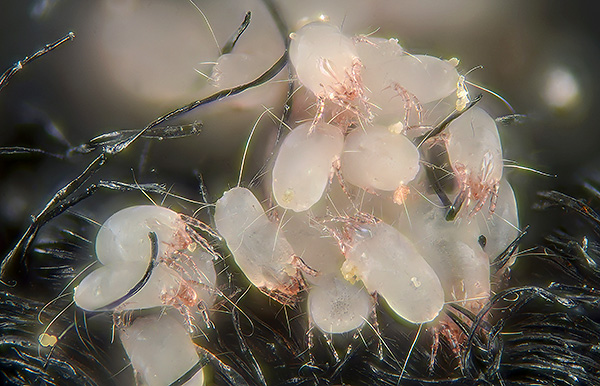 Si vous ne maintenez pas un niveau d'hygiène suffisant dans le lieu de couchage, les acariens dermatophages peuvent s'y multiplier en grand nombre.