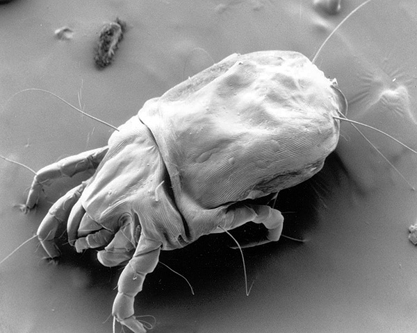 Dermatophagoides pteronyssinus au microscope électronique