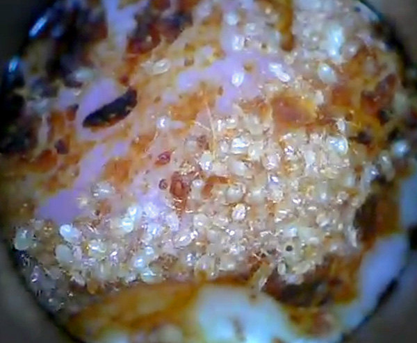 L'accumulation massive de parasites dans le conduit auditif est clairement visible.