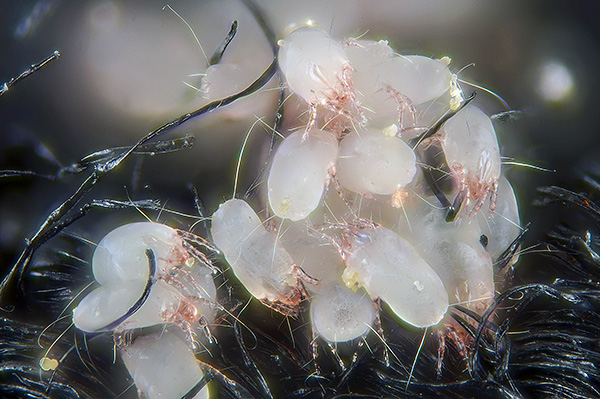 Plus il y a d'acariens dans la maison, plus le risque de développer une sensibilisation aux acariens est élevé.