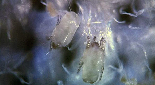 Voici à quoi ressemblent ces créatures dans un microscope optique.