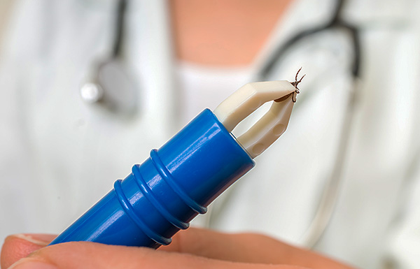 Choisir le dissolvant de pinces le plus pratique et le plus pratique...