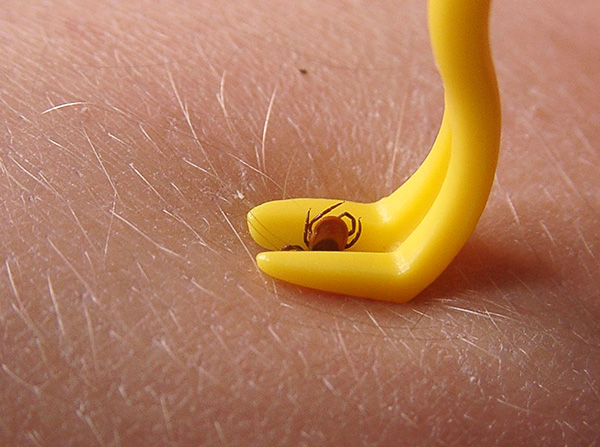 Le principe de fonctionnement de la plupart des dispositifs d'élimination des tiques consiste à tordre doucement le parasite de la peau.