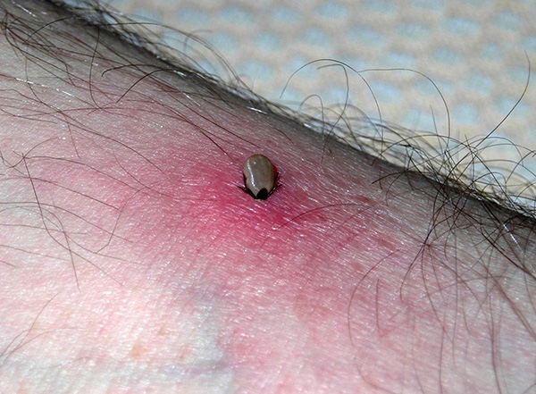 Plus la tique suce le sang longtemps, plus le risque de transmission d'infection par celle-ci est élevé (si le parasite est son porteur).