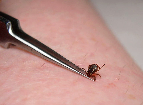 De nombreuses pincettes ne sont pas très pratiques pour extraire les tiques coincées (elles sont peu pratiques à intercepter lors de la rotation).