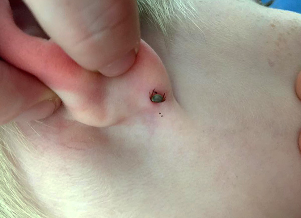 En présence d'un vaccin, en cas de piqûre de parasite, il suffit simplement de l'enlever, et il n'est pas nécessaire de prélever la tique pour analyse.