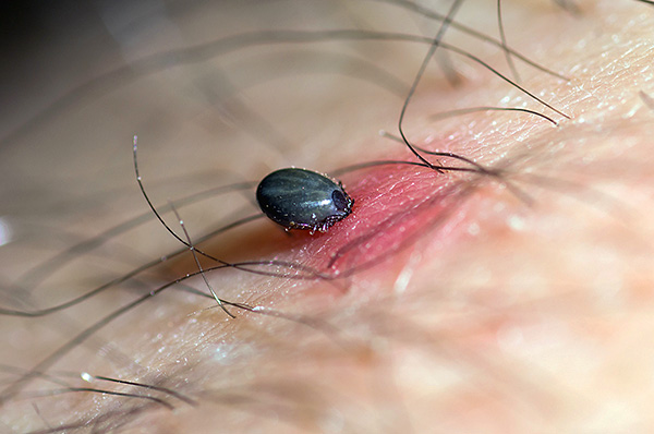 Si une personne vaccinée est mordue par une tique infectée par le virus TBE, la maladie ne se développera pas ou se déroulera sous une forme très bénigne.