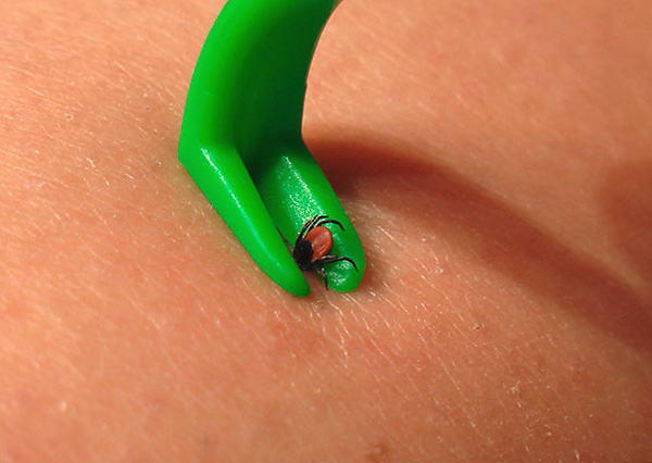 Voyons comment dévisser correctement la tique et dans quelle direction il faut la tordre ...