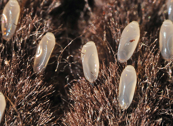 Lentes de poux de lin sur les vêtements