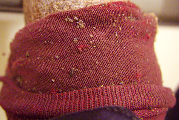 Voici à quoi ressemblent les poux de lin