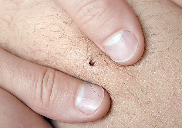 Dans la plupart des cas, les personnes expérimentées retirent rapidement et avec succès les tiques avec leurs doigts.