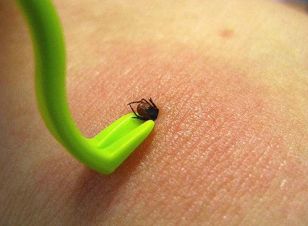 Pince en forme de crochet recourbé.