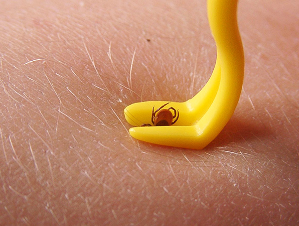 Twister de pinces en plastique sous la forme d'un crochet.