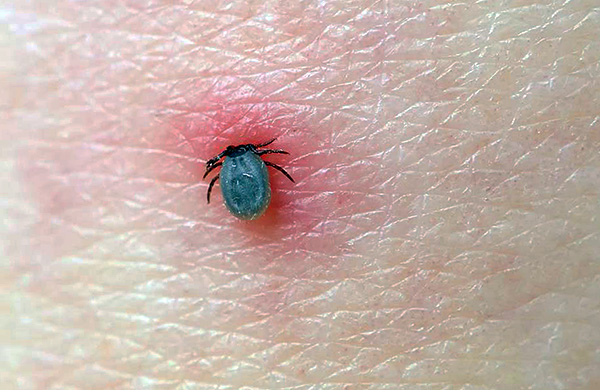 Au cours de l'alimentation, l'organisme du parasite se développe rapidement.