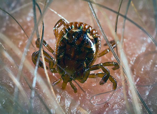 Dans de nombreuses régions de Russie, lorsqu'elle est mordue par des tiques, une personne peut être infectée par des infections mortelles ...