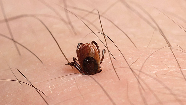 L'infection peut survenir même si la tique vient d'être attachée puis immédiatement retirée.