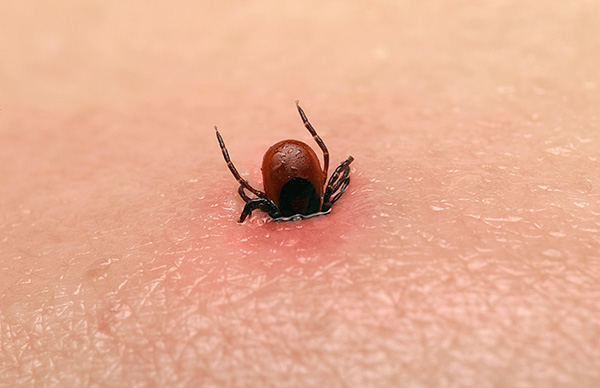 Voici à quoi ressemble la tique quelques heures après la morsure.