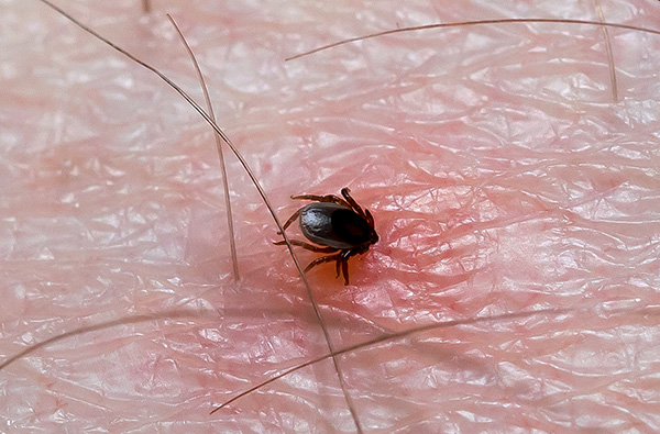 Par l'apparition d'une tique aspirée, il est impossible de déterminer si elle est infectée par une infection ou non.