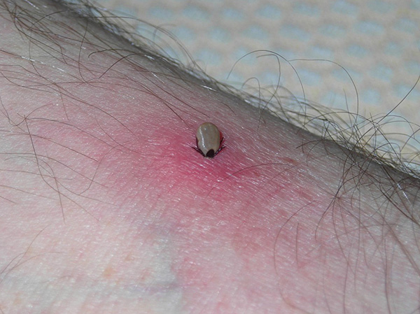 Plus le parasite boit du sang longtemps, plus il est susceptible de contracter une infection transmise par les tiques.