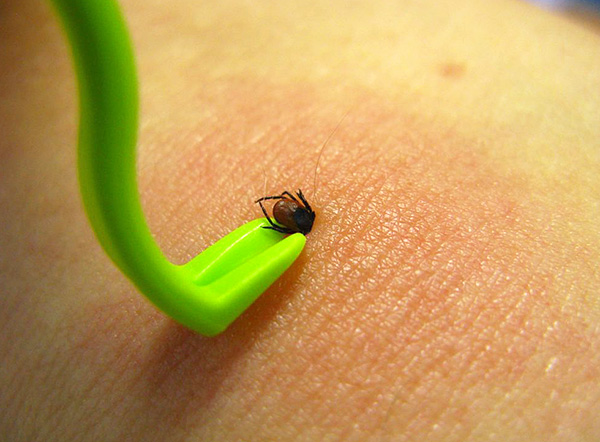 Avec un tel téléscripteur, vous pouvez supprimer le parasite en quelques secondes seulement.