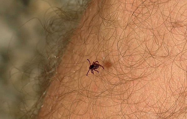 Le parasite peut facilement s'accrocher aux vêtements ou aux cheveux sur les jambes.