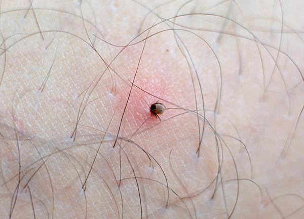 Les tiques ixodides sont porteuses d'un certain nombre de maladies dangereuses.