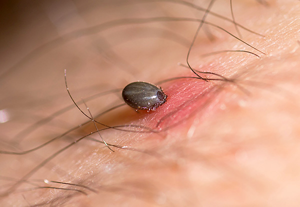 Certains types d'acariens parasitiformes font l'objet d'une attention particulière, car ils sont porteurs de maladies dangereuses.