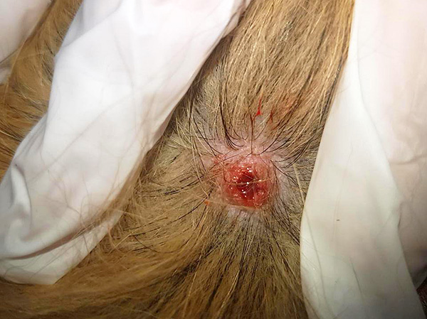 Si la marque de morsure de tique ne guérit pas pendant une longue période, le chien doit être montré au vétérinaire.